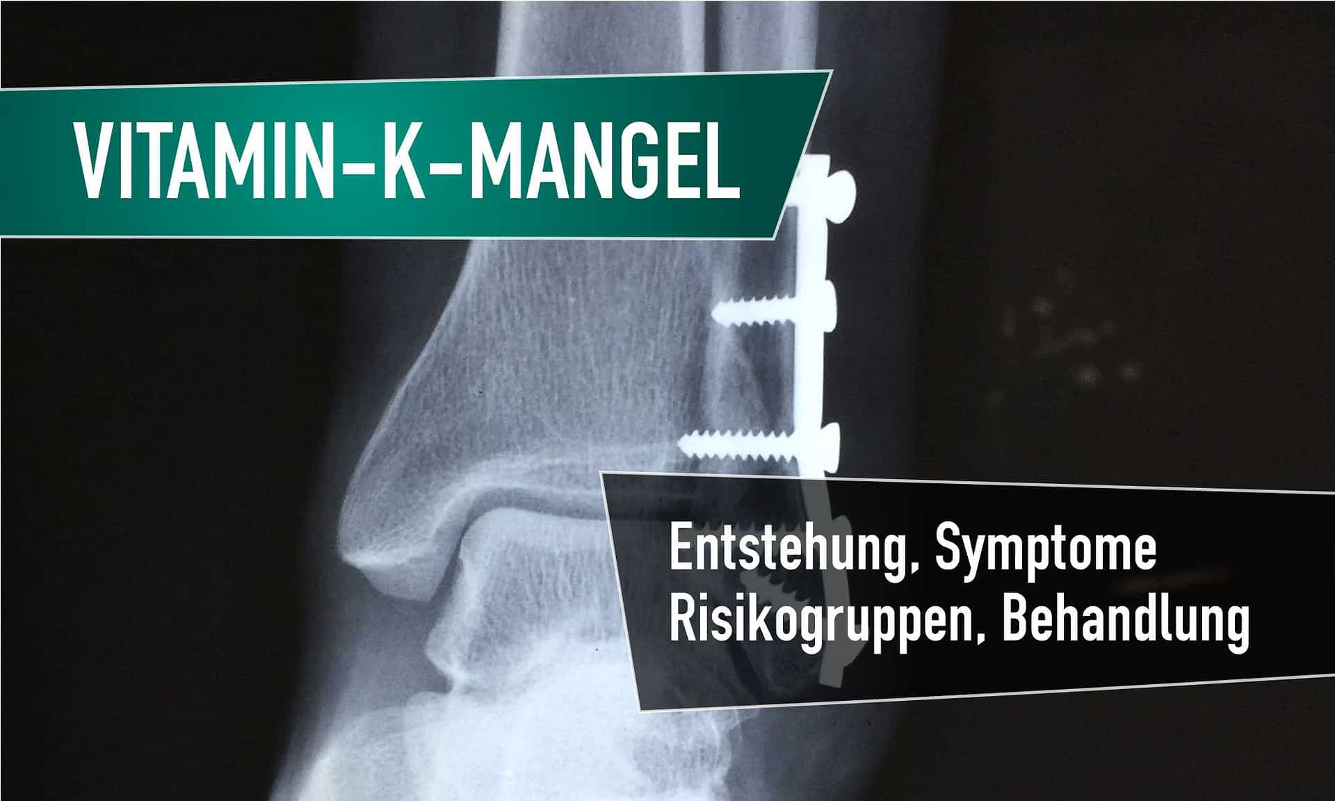 Vitamin K Mangel wie du ihn erkennst und behandeln kannst naturalie
